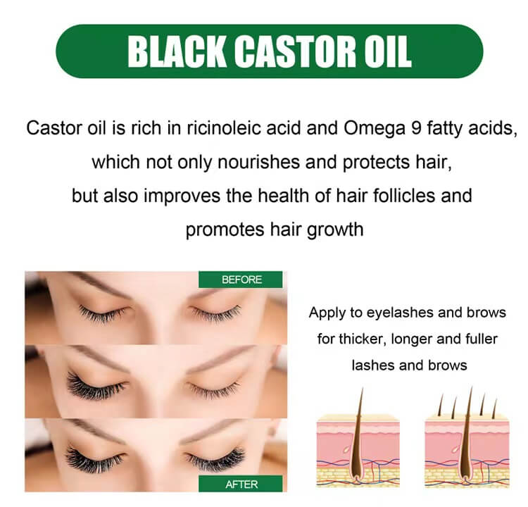 5 Pcs 120 ML 4.26 fl.oz Organic Black Castor Oil